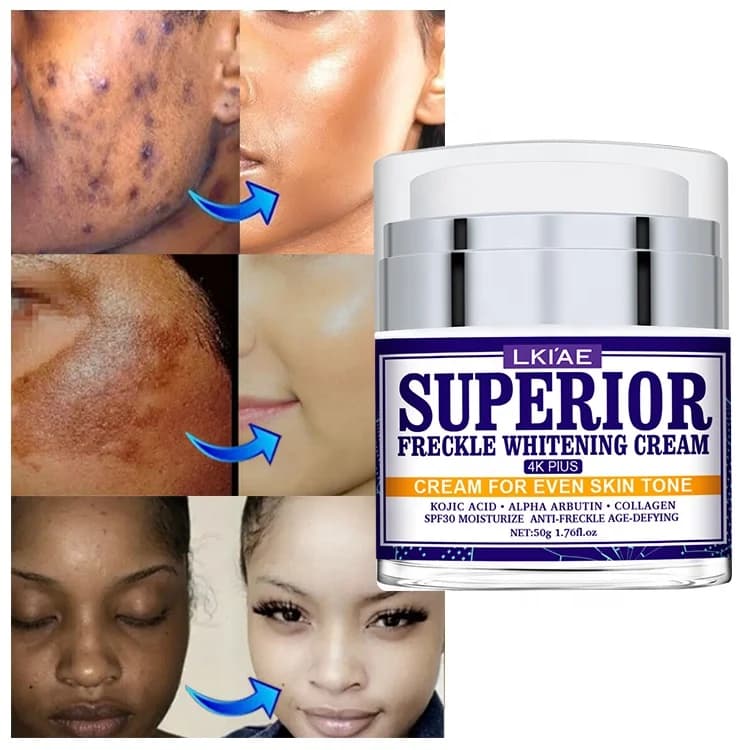 LKIAE كريم تفتيح النمش المتفوق - SPF 30، حمض الكوجيك، مضاد للشيخوخة